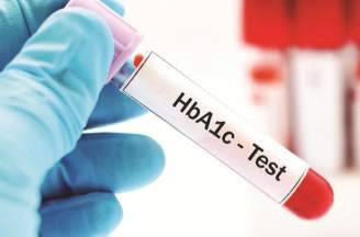Nguyên lý xét nghiệm hba1c trong theo dõi bệnh tiểu đường