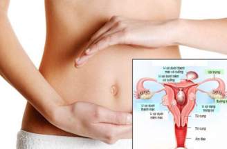 Triệu chứng của bệnh u xơ tử cung nữ giới là gì